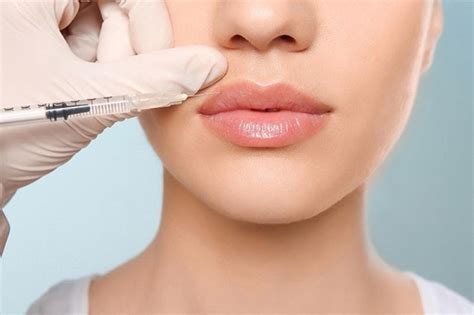 Tổng quan về tiêm filler có tác hại gì không Các thông tin cần biết