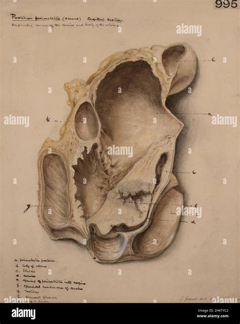 Sagittal Section Of The Female Genital Organs Hi Res Stock Photography