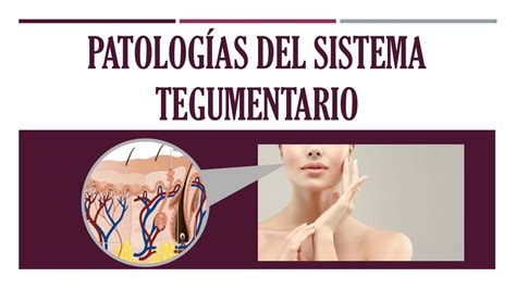 Patolog As Del Sistema Tegumentario Takistudy Udocz