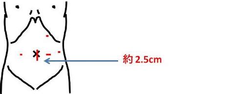 腹腔鏡下手術の現況｜医療法人慶仁会 城山病院