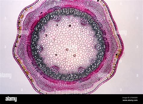 Sambucus Stem Cross Section Showing Epidermis Cortex Phloem Cambium