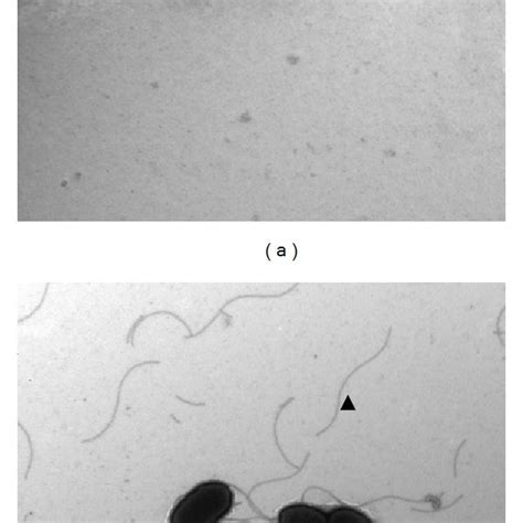 Observation Of Salmonella Enterica Subsp Enterica Serovar Typhimurium