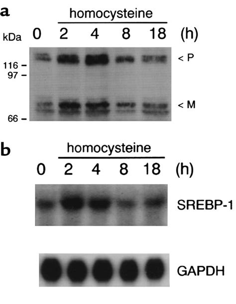 Jci Homocysteine Induced Endoplasmic Reticulum Stress Causes