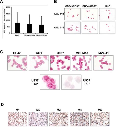 Expression Of Brd4 In Leukemic Cells In Acute Myeloid Leukemia Aml