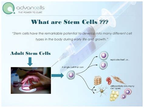 Multiple Sclerosis Treatment Stem Cell Treatment For Multiple Scler