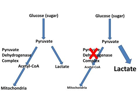 Pyruvate Dehydrogenase Complex Deficiency Disease; Ataxia with Lactic ...