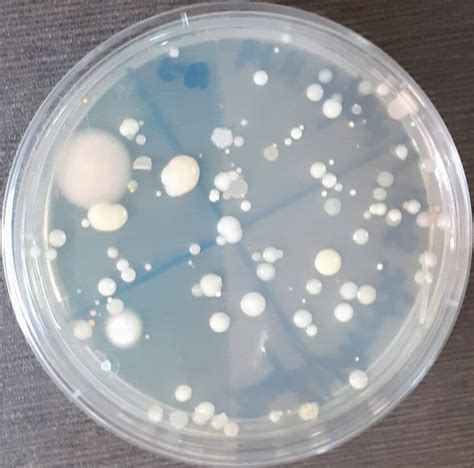 Bacterial culture plate in NA medium | Download Scientific Diagram