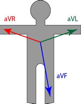 Lectrodes Et D Rivations De L Ecg Comment Bien Les Positionner