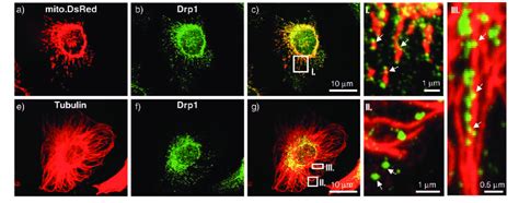 Subcellular Localisation Of Endogenous Drp1 In Hela Cells Hela Cells