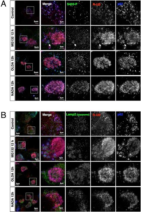 Super Resolution Microscopy Sr Sim Revealed That The Aggresome