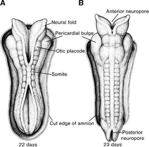 Embryology Of Neural Tube Development Sadler 2005 American Journal Of Medical Genetics