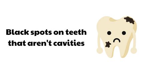 Black Spots On Teeth That Aren T Cavities Spring Orchid Dental