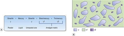 6: Dental amalgam | Pocket Dentistry