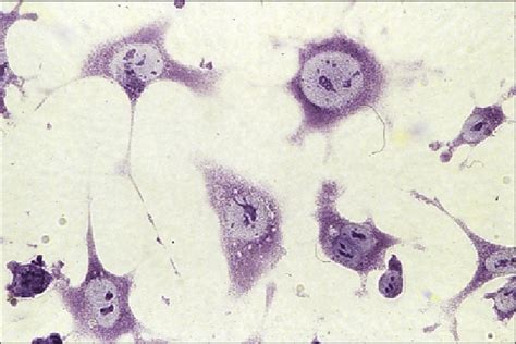 Light Micrograph Of Second Passage Chondrocytes Grown In Monolayer