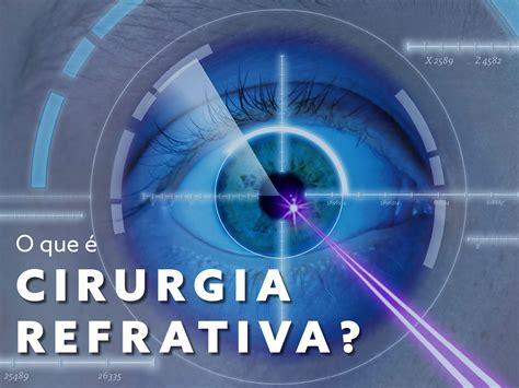 O que é cirurgia Refrativa Oftalmo Santos