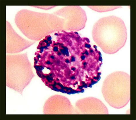 Anatomy & Physiology 243: Basophil