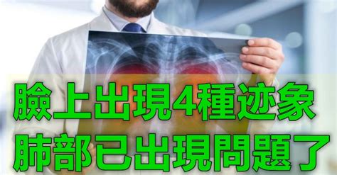 臉上出現4種跡象！肺部已經出現問題了 肺癌發生有兩大因素「其中一個很危險」風險要高20倍 讀讀