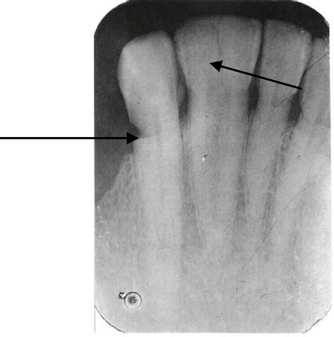 The Radiology Of Developmental Dental Defects Demystified An E Based