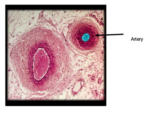 Ap Lab Artery Vein Histology Practical Flashcards Quizlet