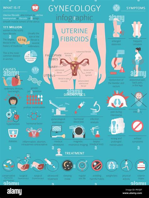 Uterine Fibroids Ginecological Medical Desease In Women Infographic