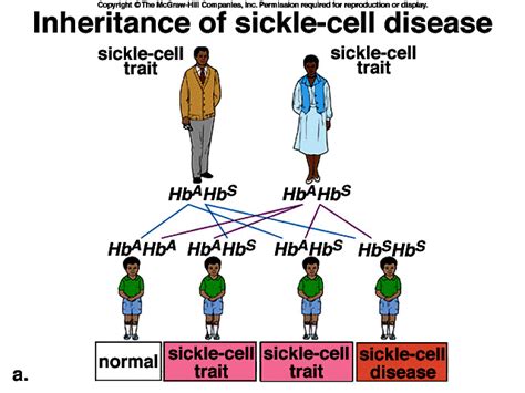 Health: Living with Sickle Cell Anemia – Genesis International