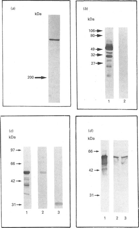 Immunological Identification Of Ct And Ct Fusion Proteins In