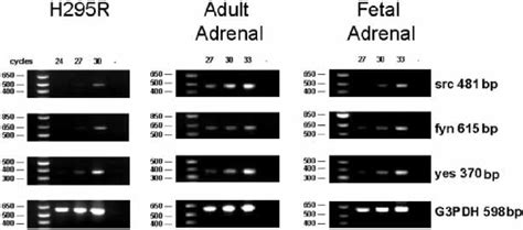 Semi Quantitative Rt Pcr Analysis Of The Levels Of Src Fyn And Yes Download Scientific Diagram