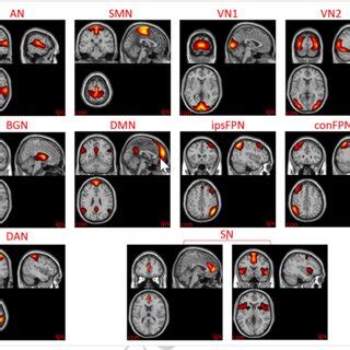 The Spatial Maps Of Ten Resting State Networks Abbreviations AN