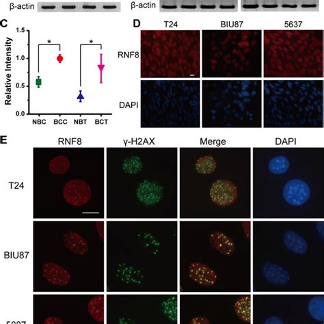 Knockdown Of RNF8 Impairs The Radioresistance Of Bladder Cancer Cells