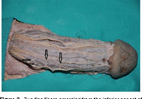 Figure 2 From Anatomy Of The Dorsal Nerve Of The Penis Clinical