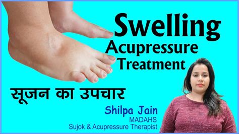 Best Acupressure Points For Leg Swelling I Body Swelling I Sujok Therapy I Colour Therapy Youtube