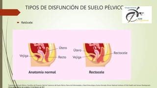 Prolapso Y Disfunci N De Piso P Lvico Daniel Pptx