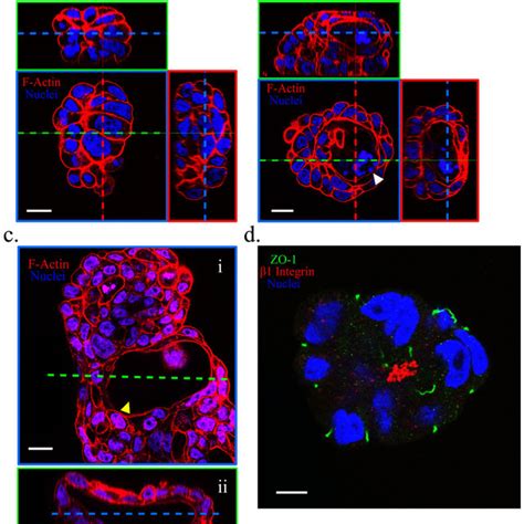 Calu Cells Underwent Different Morphologic Changes On The Nanograss