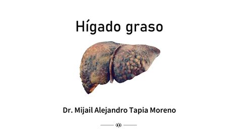 Hígado graso Esteatosis hepática no alcohólica Dr Mijail Tapia