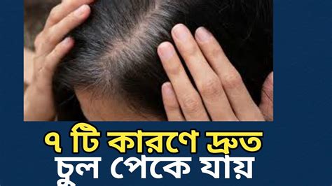 ৭ টি কারণে দ্রুত চুল পেকে যায় Health Tips Health Tips Bangla