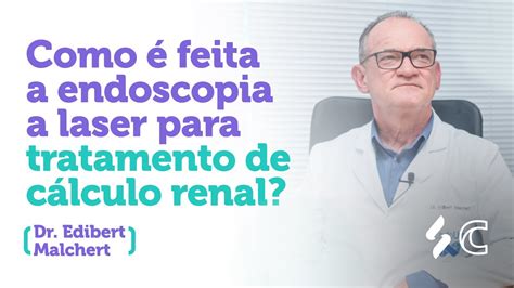 Como é feita a endoscopia a laser para tratamento de calculo renal