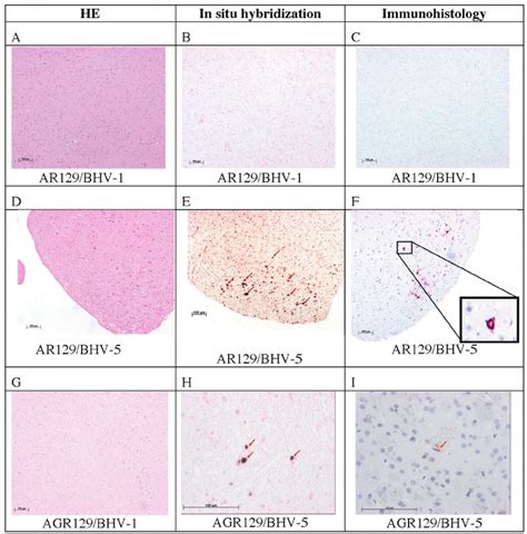 Analysis Of Mouse Brains From Bhv And Bhv Infected Mice By