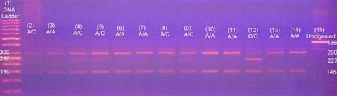 Gel Electrophoresis For XPD Lys751Gln AC Polymorphism Showing DNA