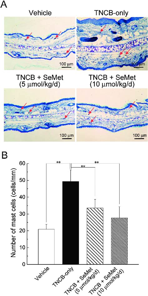 Number of Mast Cells Dermal mast cells (arrows) were stained with... | Download Scientific Diagram