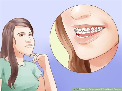 How To Determine If You Need Braces With Pictures Wikihow