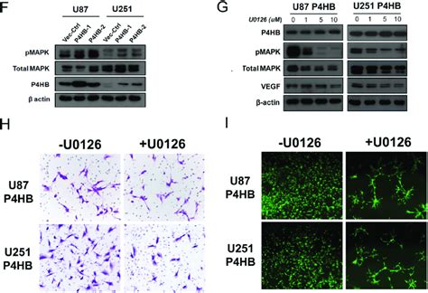 Transient Over Expression Of P4hb Promoted Glioma Cell Proliferation