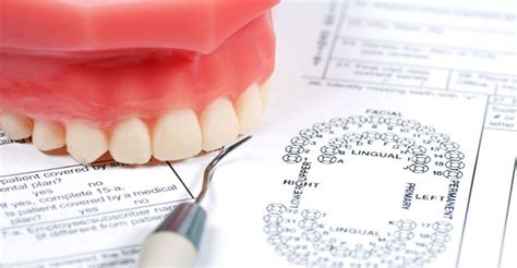 Dentures; A Solution For Missing Teeth | Alternative Drugs