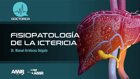 FISIOPATOLOGÍA Y ASPECTOS CLÍNICOS DE LA ICTERICIA | Ictericia ...