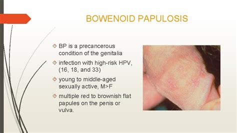 Pre Cancerous Lesions Of The Skin Mucosa Neirita