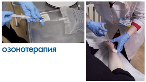 Озонотерапия – оздоровительные процедуры в санатории Летцы в Беларуси