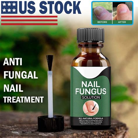 Anti Fungal Treatment Extra Strength Toenail Fungus Fungi Xs Nail