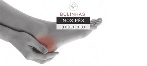 Bolinhas Na Sola Do Pé - Bolinhas nos Pés: Tratamento Pápulas Podais Piezogénicas Lisboa