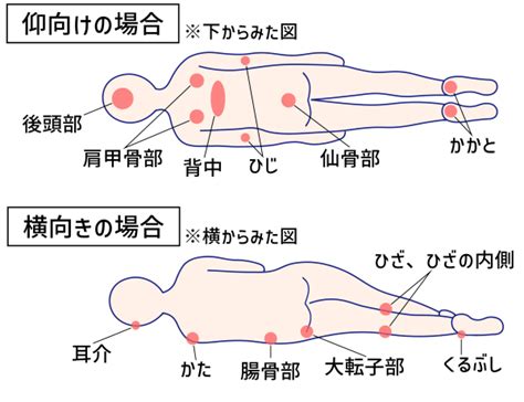 専門家監修褥瘡 床ずれ のケア方法は在宅での処置や治療予防法を徹底解説 サービス付き高齢者向け住宅の学研ココファン