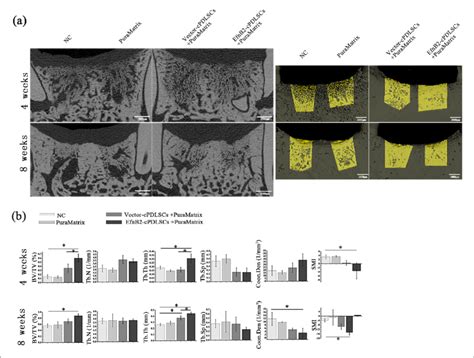 Two Dimensional D And Three Dimensional D Images Of New Bone