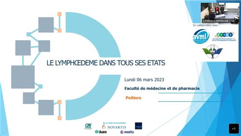 Poitiers Le Lymphœdème Dans Tous Ses états Compte Rendu